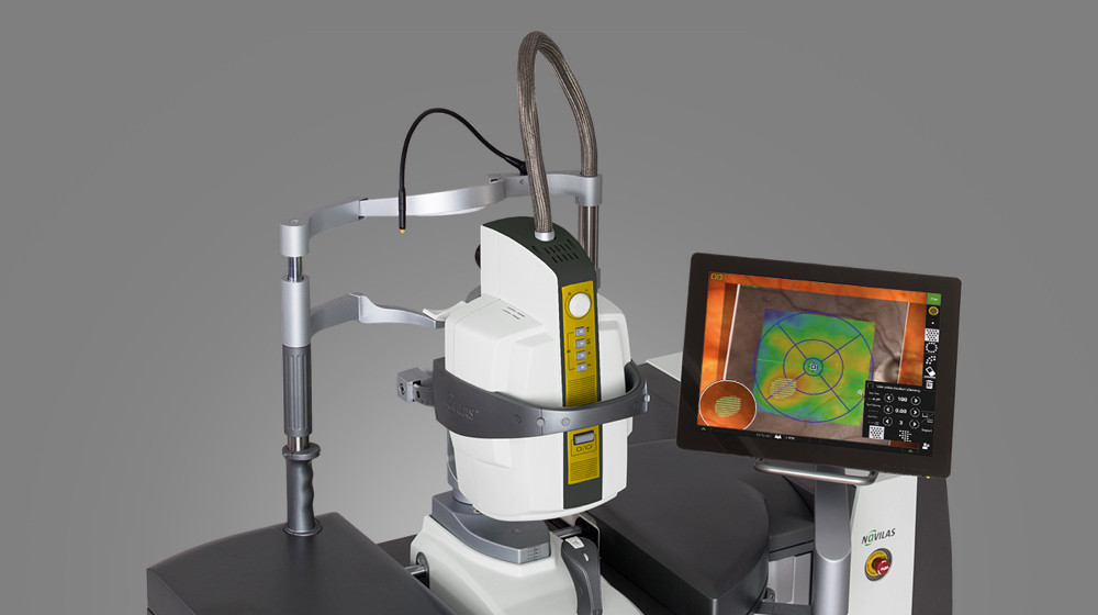 Navilas Laser System