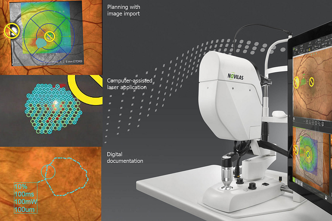 csm_Navilas_Laser_Euretina_2019_e7e5a4d503.jpg